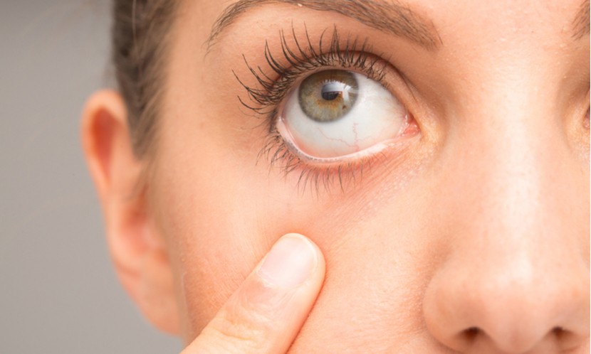 外食缺乏護眼營養素　女子3C使用時間長+3餐外食　乾眼症上身